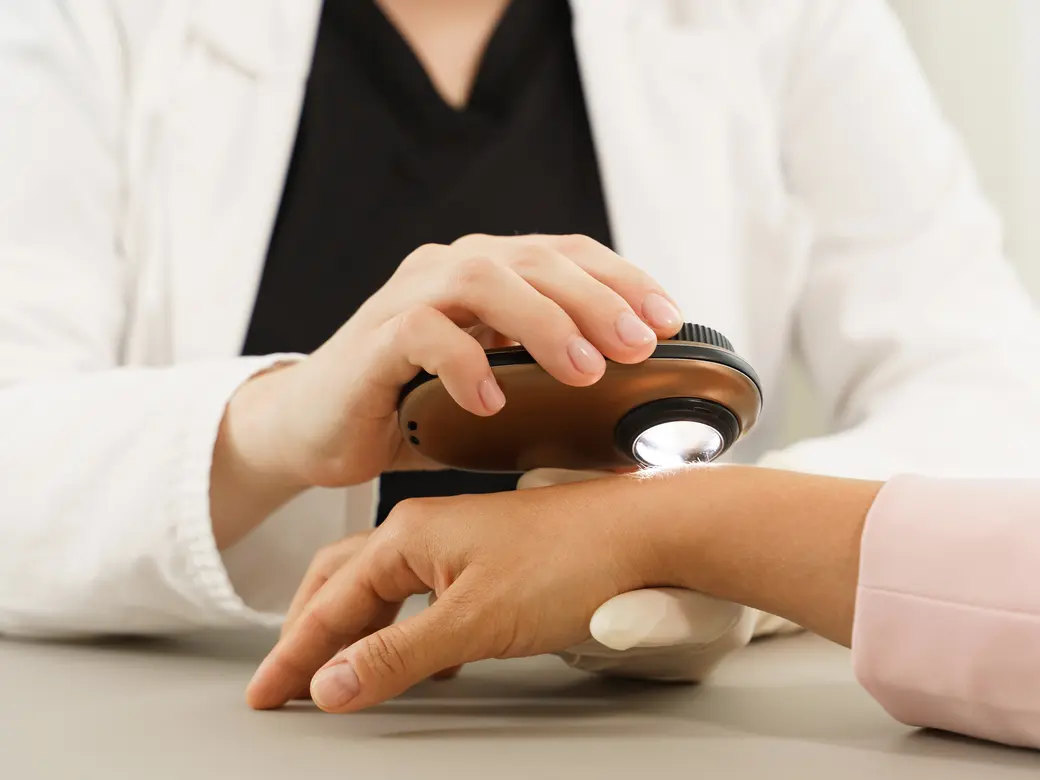 Dermatologe verwendet Dermatoskop für die Hautuntersuchung